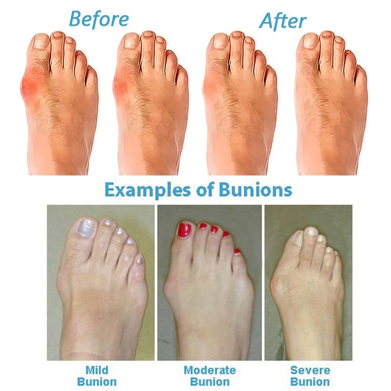 ComfortStep | Sandali Ortopedici Estivi Eleganti Per Donne